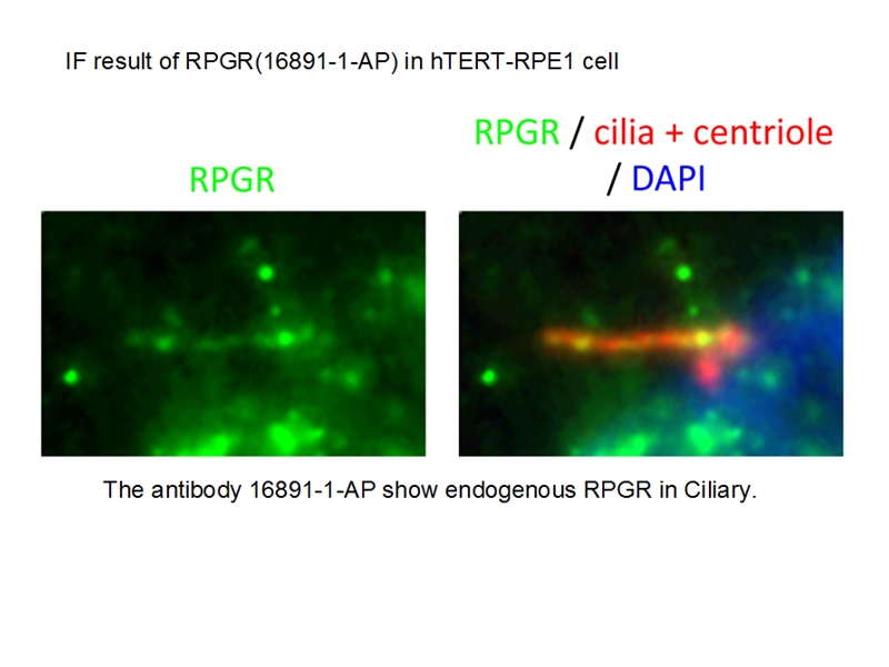 IF Staining of hTERT-RPE1 cells using 16891-1-AP (same clone as 16891-1-PBS)