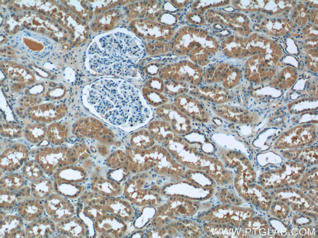 IHC staining of human kidney using 16891-1-AP (same clone as 16891-1-PBS)