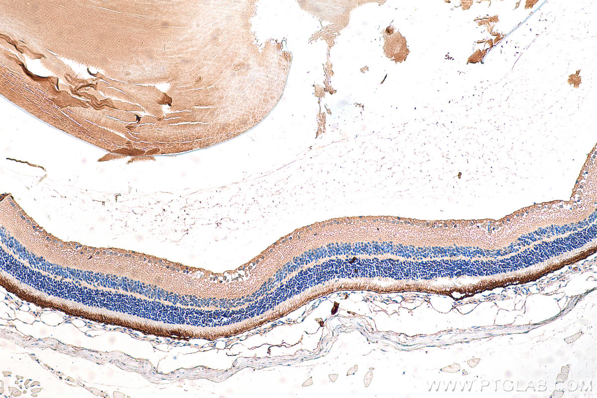 IHC staining of mouse eye using 16891-1-AP (same clone as 16891-1-PBS)
