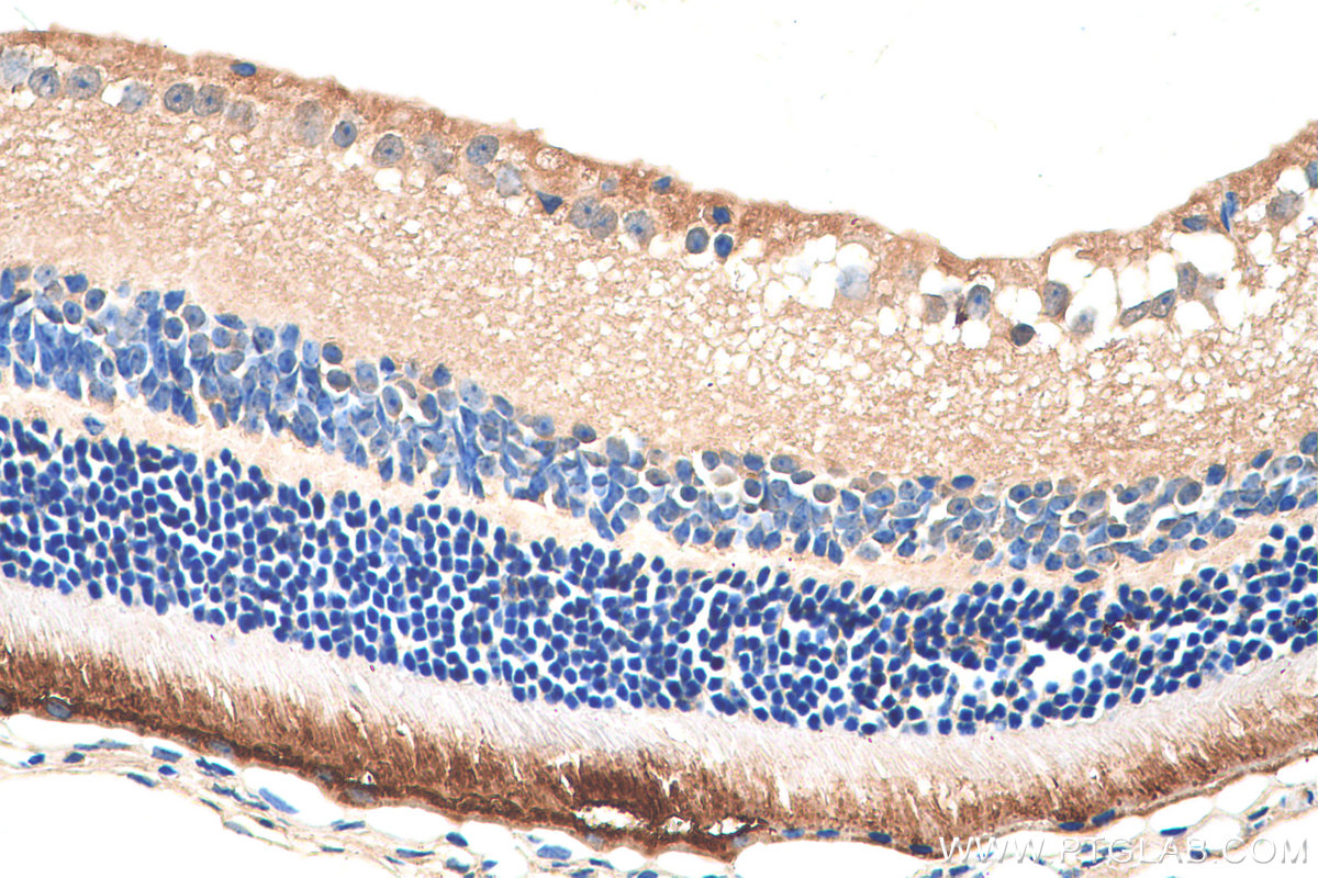 IHC staining of mouse eye using 16891-1-AP (same clone as 16891-1-PBS)