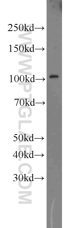 WB analysis of mouse eye using 16891-1-AP