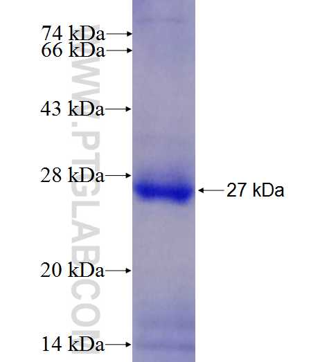 RPGR fusion protein Ag27524 SDS-PAGE