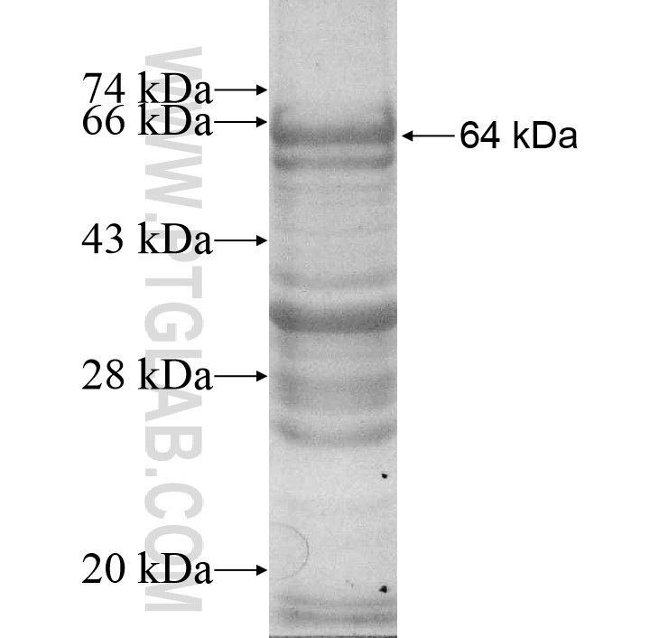 RPGR fusion protein Ag10405 SDS-PAGE