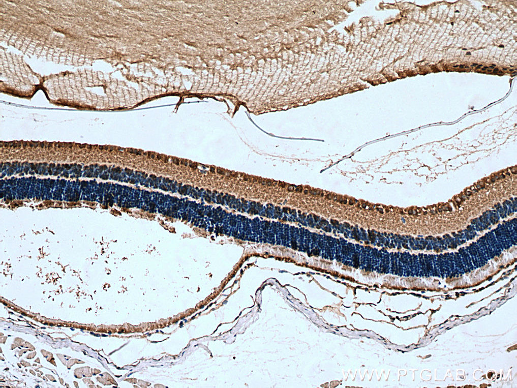 IHC staining of mouse eye using 13214-1-AP