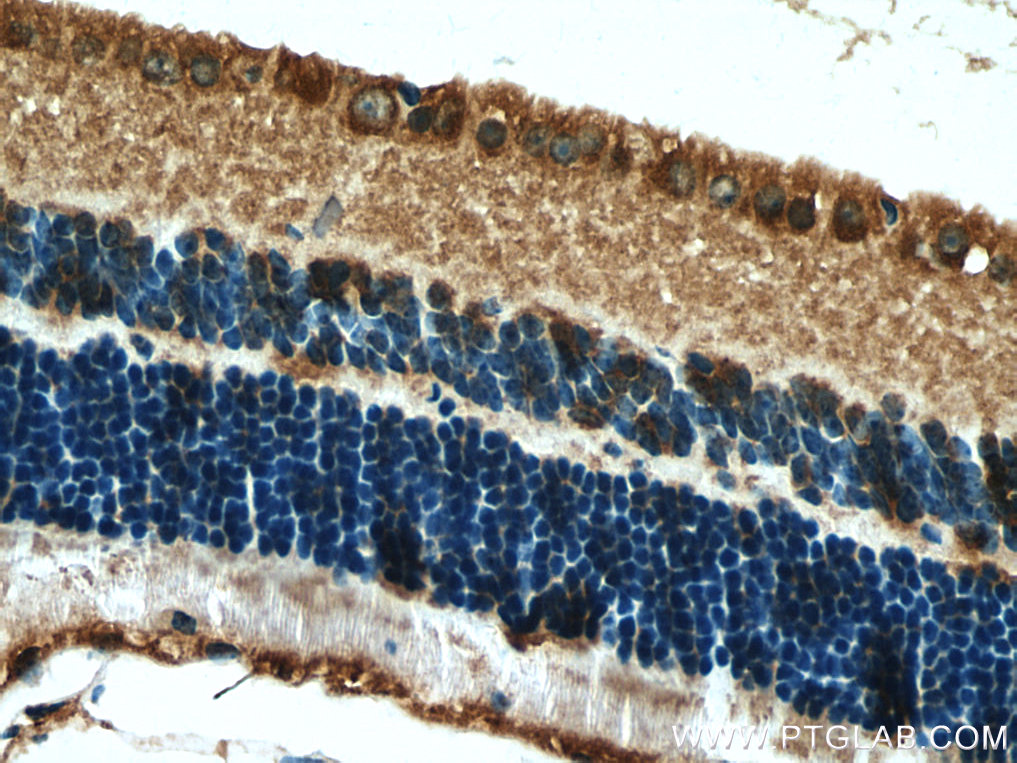 IHC staining of mouse eye using 13214-1-AP