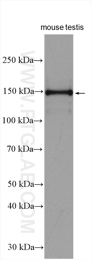 RPGRIP1L