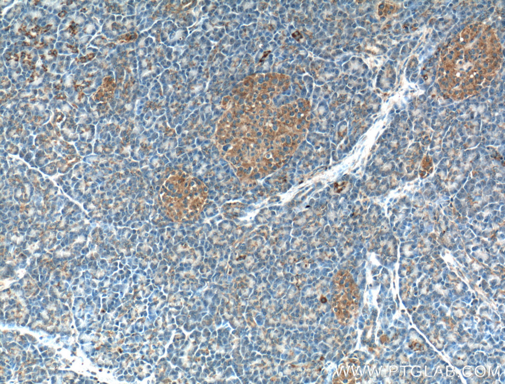 IHC staining of human pancreas using 55160-1-AP