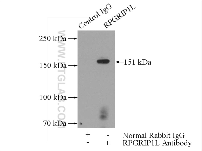 IP experiment of HEK-293 using 55160-1-AP