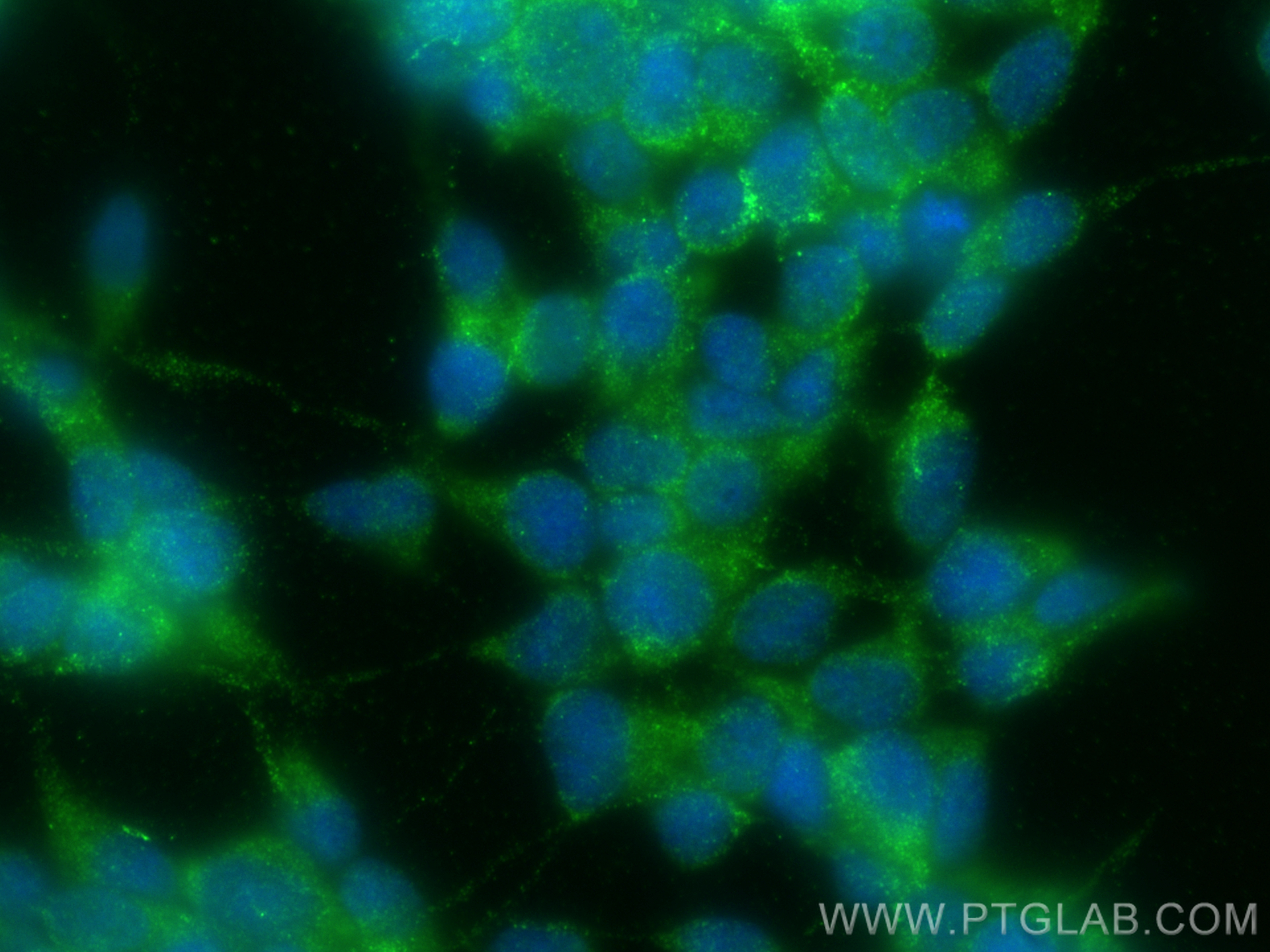 IF Staining of SH-SY5Y using 11396-1-AP