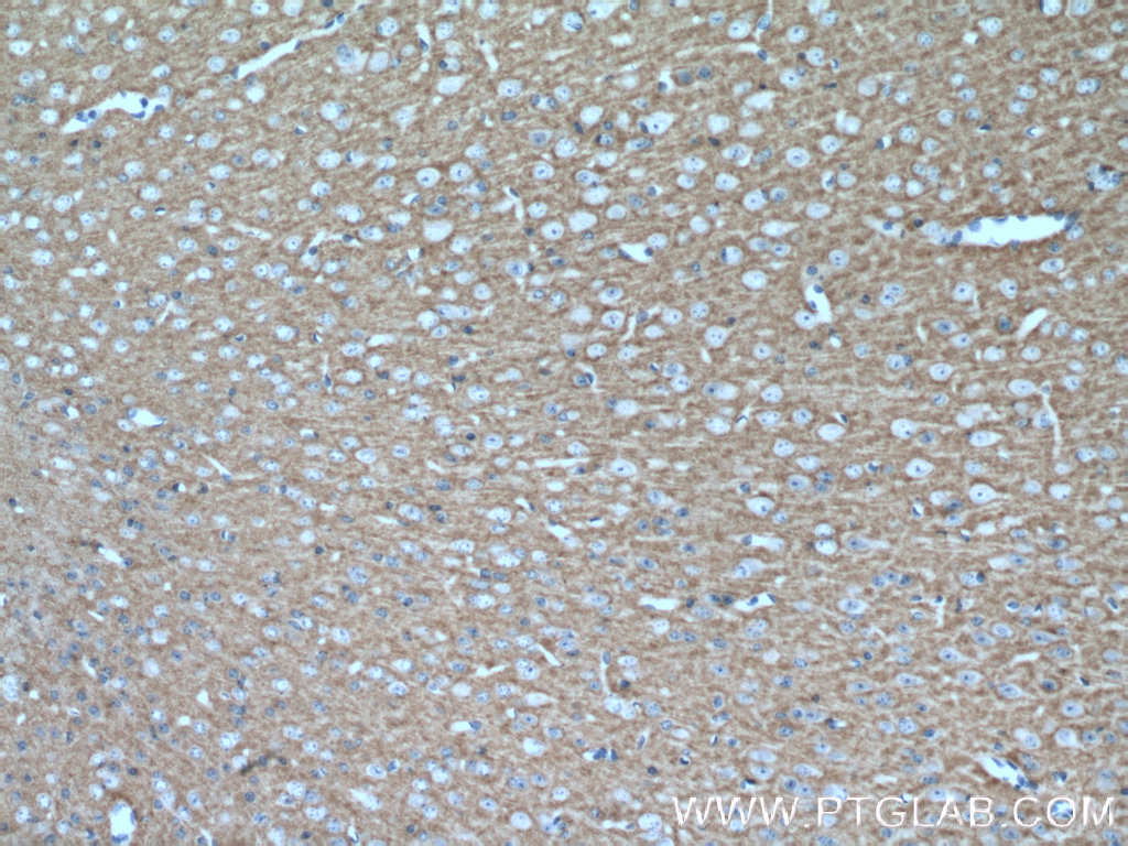 IHC staining of mouse brain using 11396-1-AP