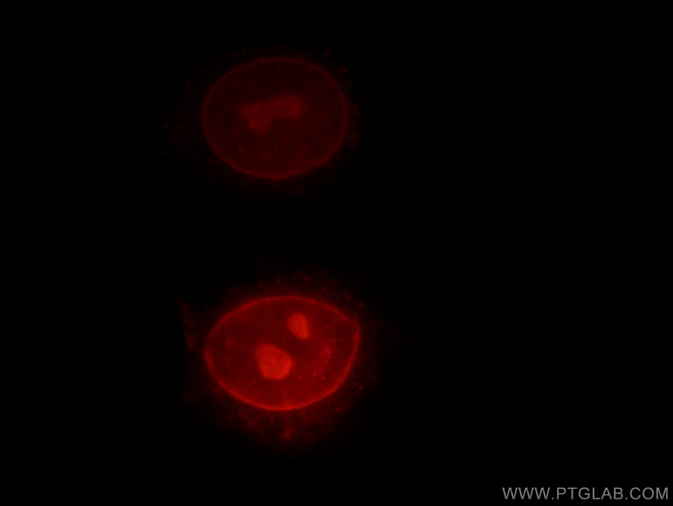 IF Staining of HepG2 using 13010-1-AP