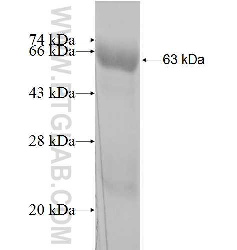 RPIA fusion protein Ag3699 SDS-PAGE