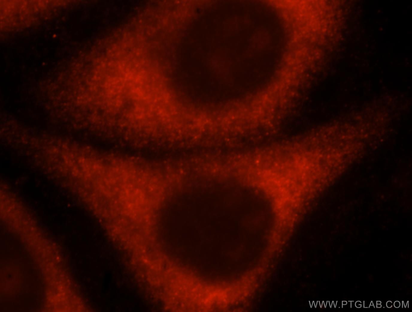 IF Staining of HepG2 using 16681-1-AP