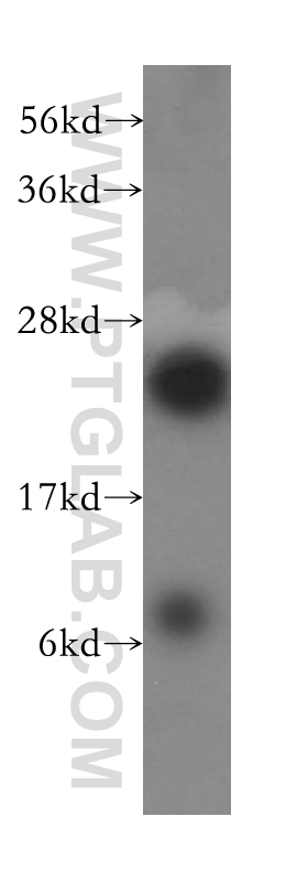 WB analysis of HepG2 using 16681-1-AP