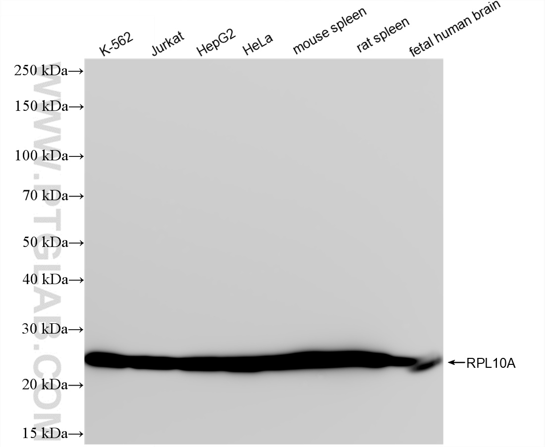 WB analysis using 85685-1-RR
