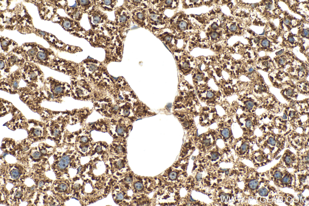 Immunohistochemical analysis of paraffin-embedded mouse liver tissue slide using RMX00046 (RPL10A antibody) at dilution of 1:500 (under 10x lens). Heat mediated antigen retrieval with Tris-EDTA buffer (pH 9.0). IHC staining of mouse liver using RMX00046