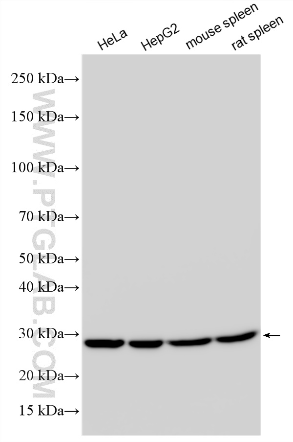 Various lysates were subjected to SDS PAGE followed by western blot with RMX00046 (RPL10A antibody) at dilution of 1:15000 incubated at room temperature for 1.5 hours. WB analysis using RMX00046