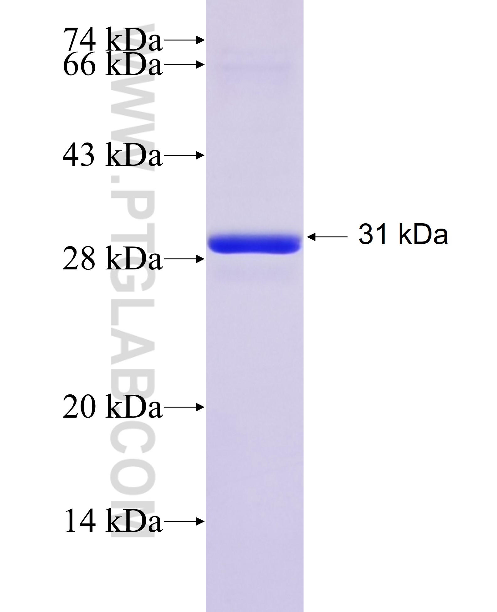 RPL10A fusion protein Ag30526 SDS-PAGE