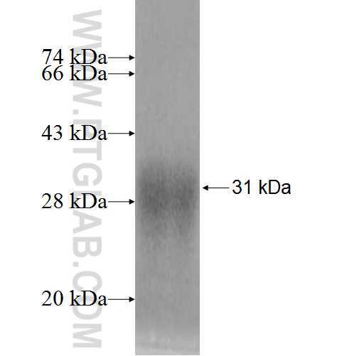 RPL10L fusion protein Ag9575 SDS-PAGE RPL10L fusion protein Ag9575 SDS-PAGE
