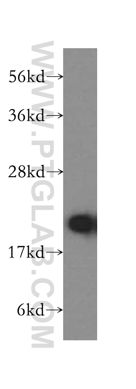 WB analysis of human liver using 16277-1-AP