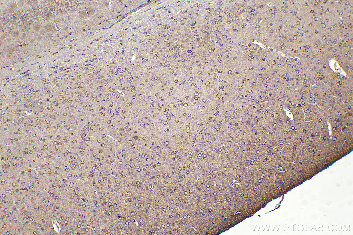 IHC staining of mouse brain using 14536-1-AP