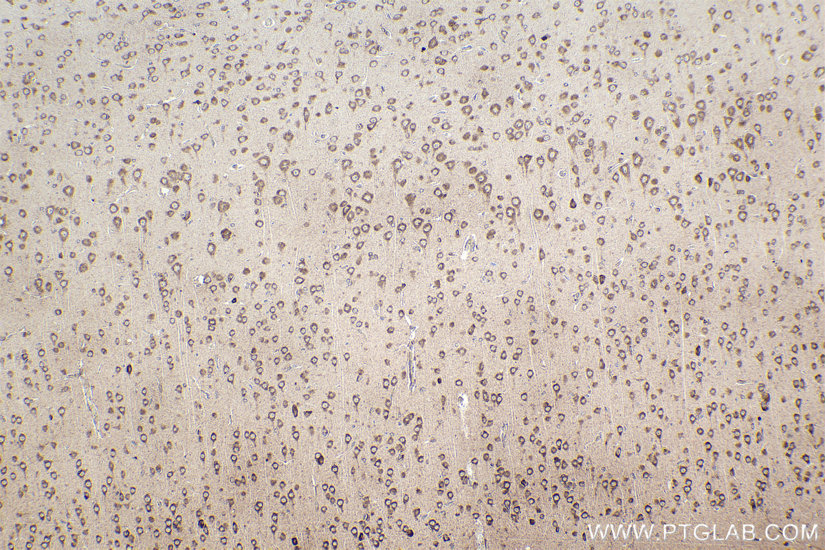IHC staining of rat brain using 14536-1-AP