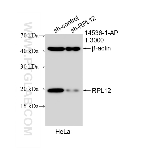 WB analysis of HeLa using 14536-1-AP