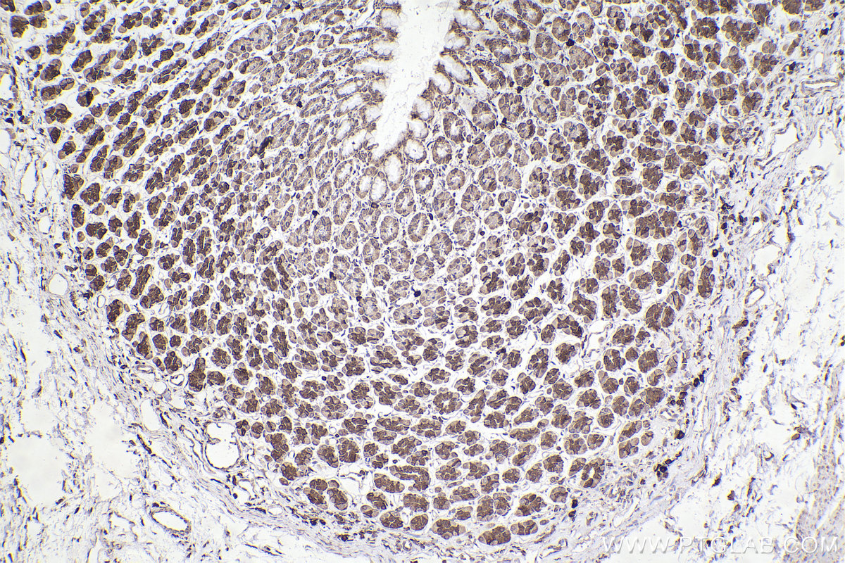 IHC staining of rat stomach using 68110-1-Ig (same clone as 68110-1-PBS)