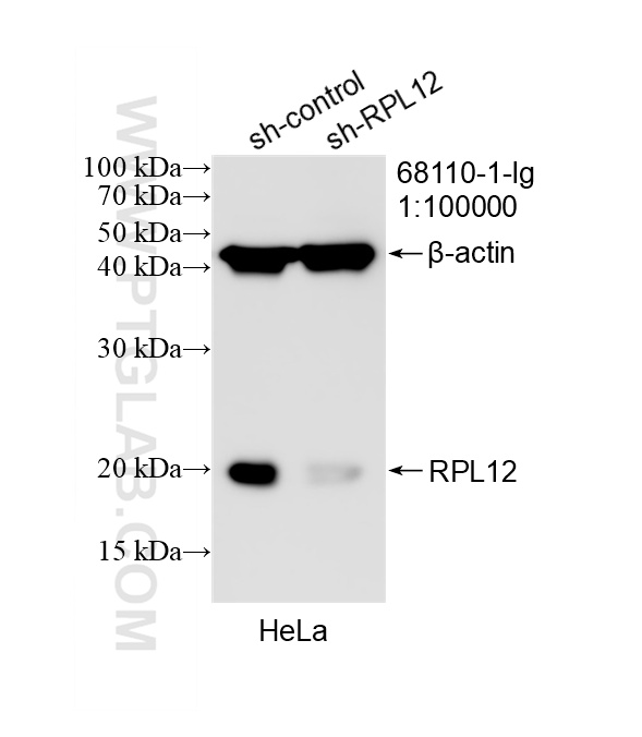 WB analysis of HeLa using 68110-1-Ig (same clone as 68110-1-PBS)