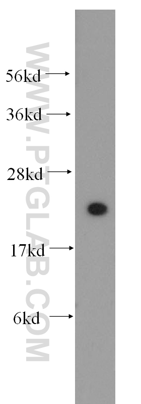 WB analysis of HeLa using 11271-1-AP