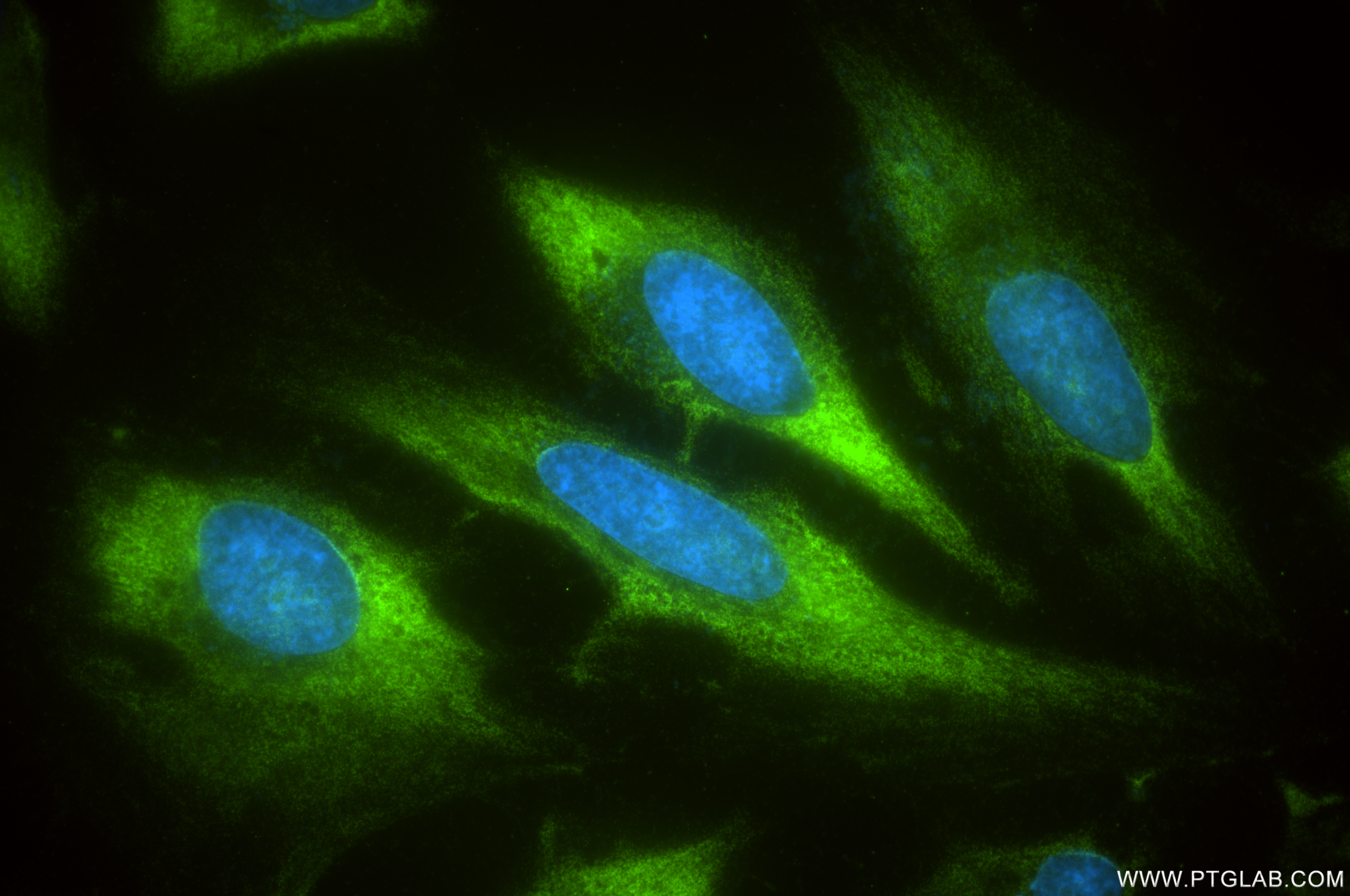 IF Staining of HeLa using 86205-2-RR