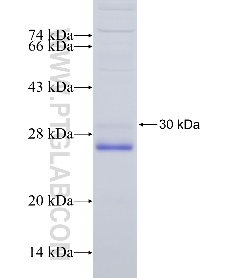 RPL13A fusion protein Ag6321 SDS-PAGE RPL13A fusion protein Ag6321 SDS-PAGE