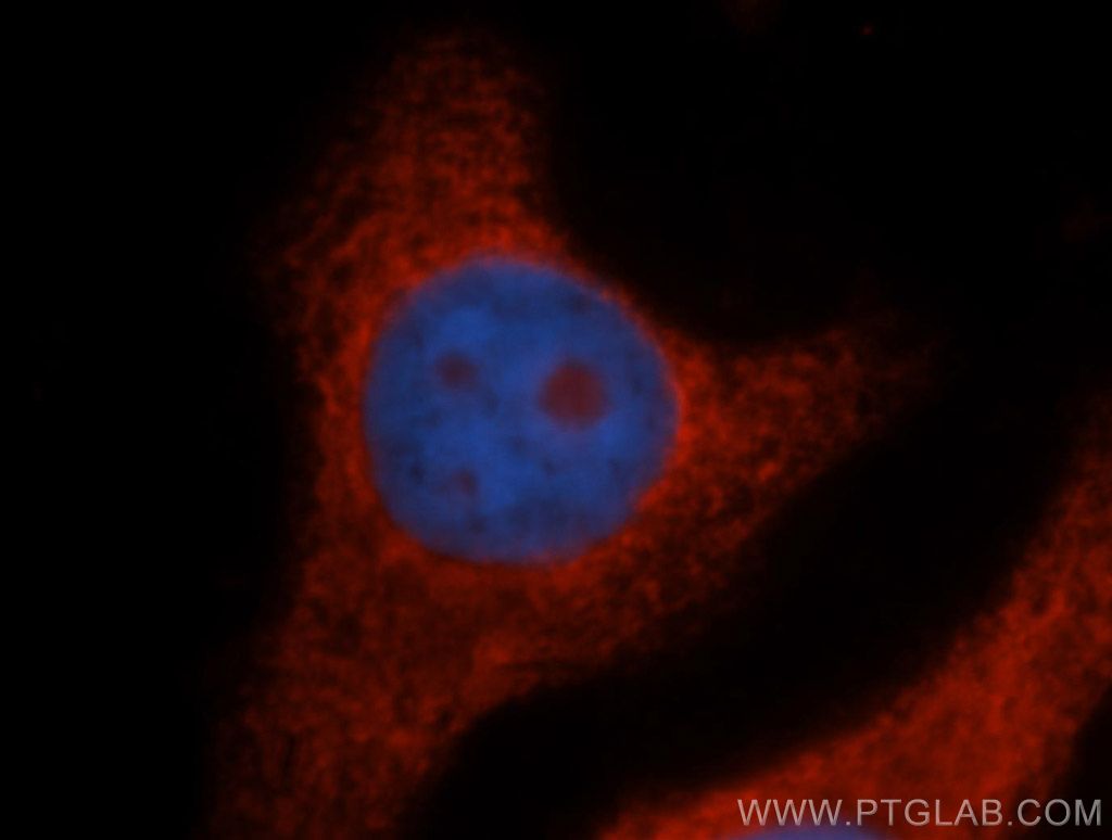 IF Staining of HepG2 using 14991-1-AP