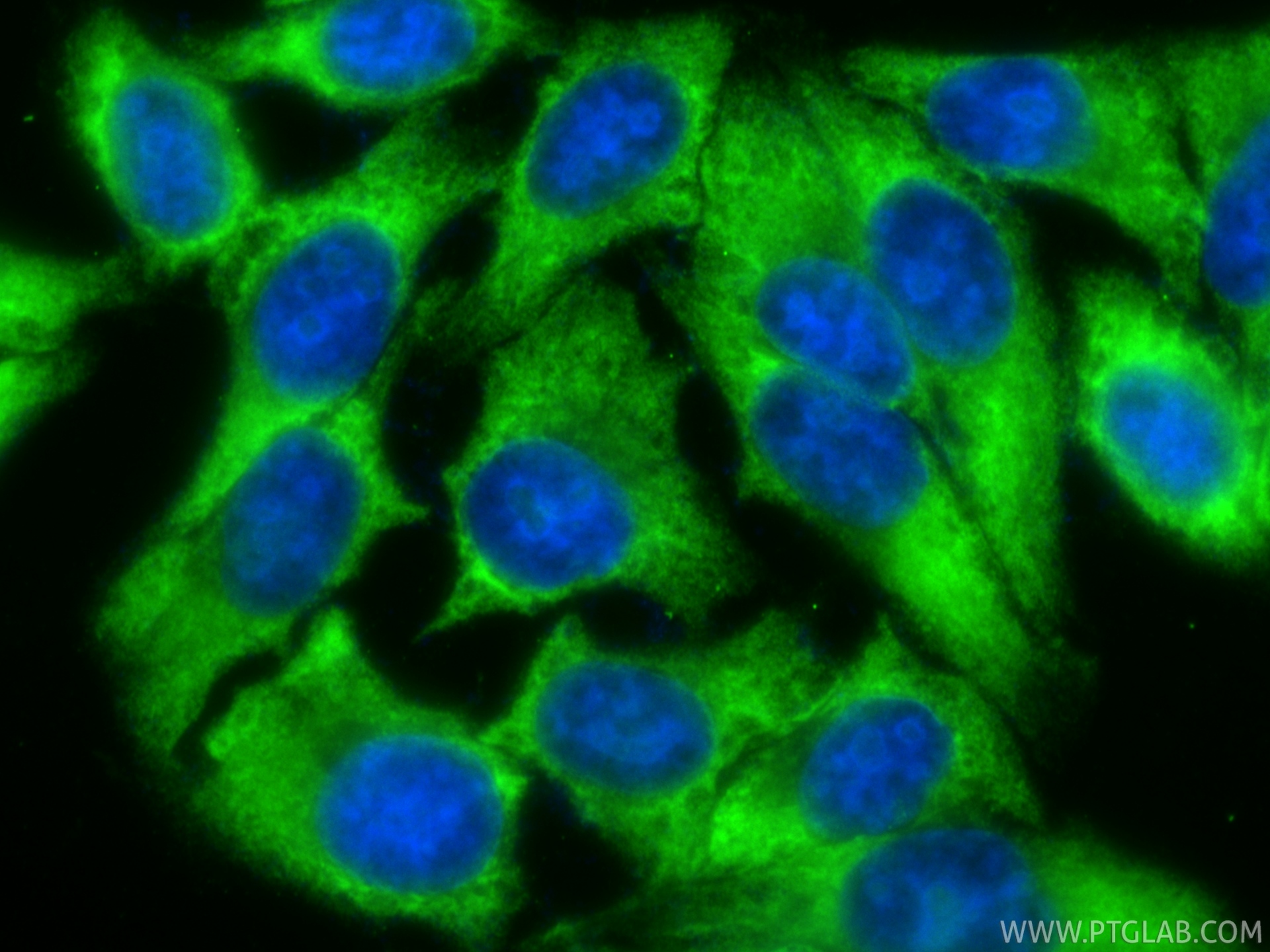 IF Staining of HepG2 using CL488-82688 IF Staining of HepG2 using CL488-82688
