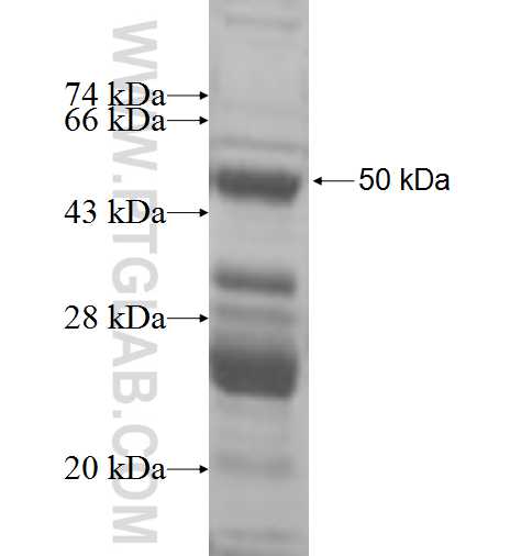 RPL15 fusion protein Ag9965 SDS-PAGE RPL15 fusion protein Ag9965 SDS-PAGE