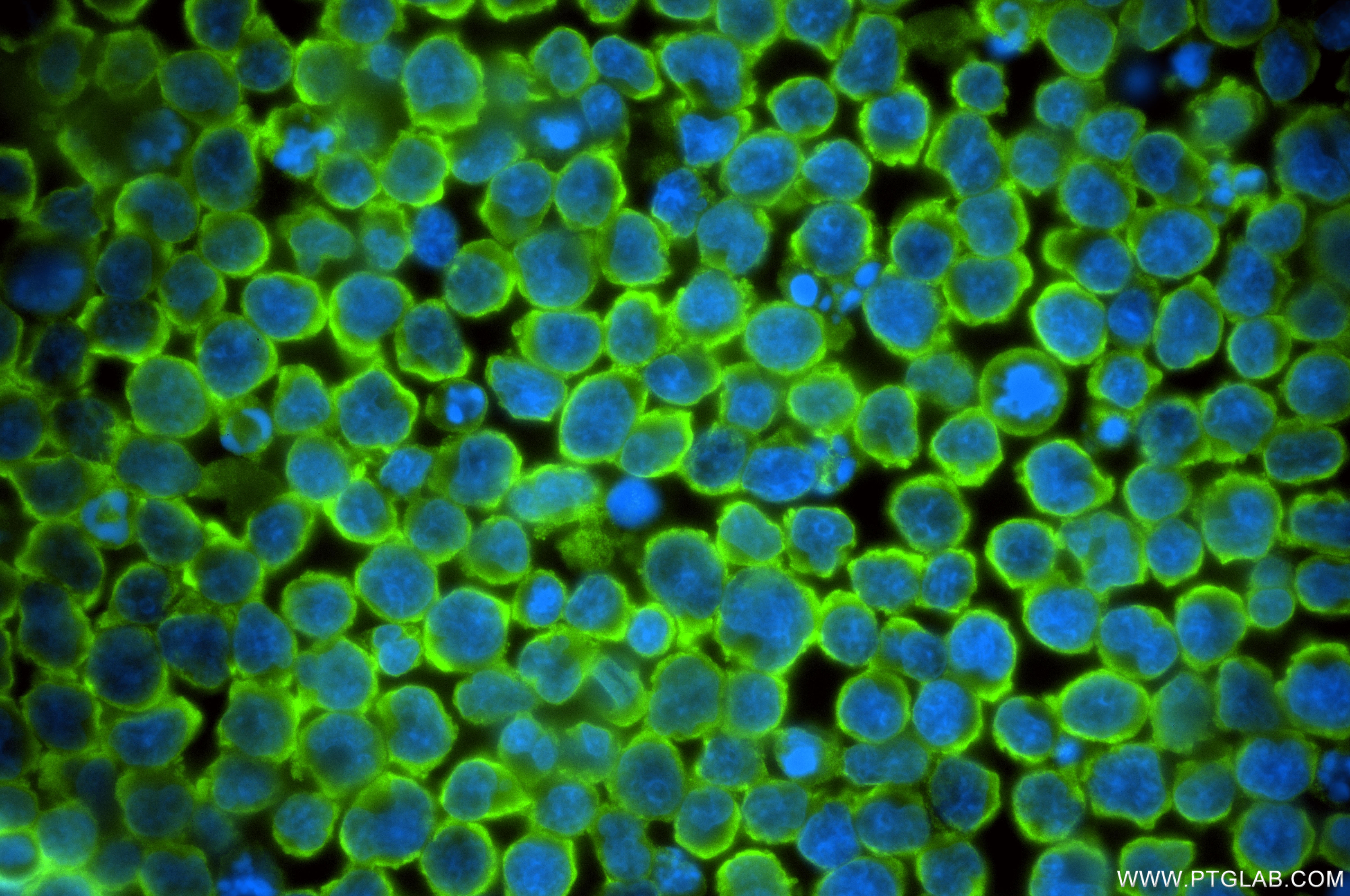 IF Staining of Jurkat using 86348-3-RR