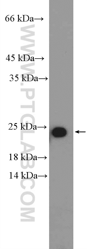 WB analysis of HeLa using 17029-1-AP