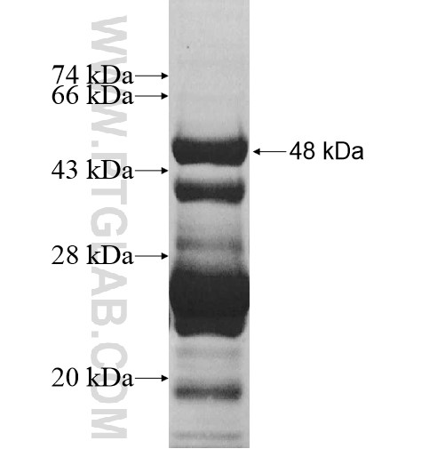 RPL18 fusion protein Ag10444 SDS-PAGE RPL18 fusion protein Ag10444 SDS-PAGE