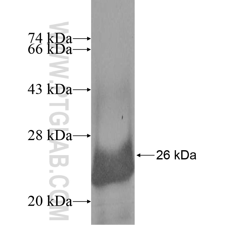 RPL18A fusion protein Ag8267 SDS-PAGE RPL18A fusion protein Ag8267 SDS-PAGE