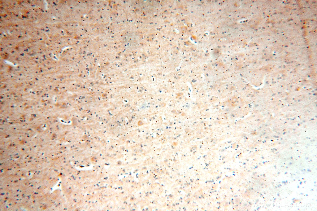 IHC staining of human brain using 14701-1-AP