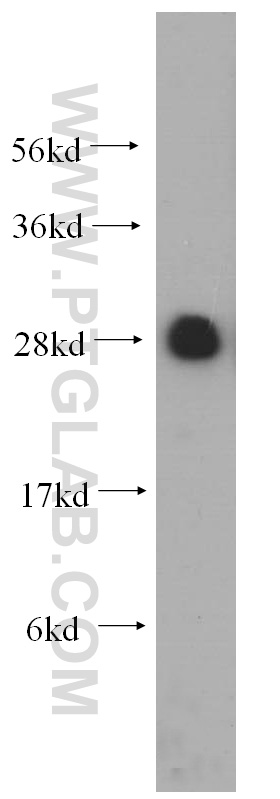 WB analysis of HeLa using 14701-1-AP