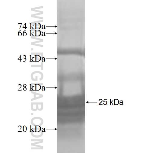 RPL21 fusion protein Ag7467 SDS-PAGE RPL21 fusion protein Ag7467 SDS-PAGE