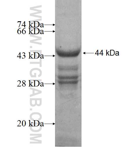 RPL24 fusion protein Ag7094 SDS-PAGE RPL24 fusion protein Ag7094 SDS-PAGE