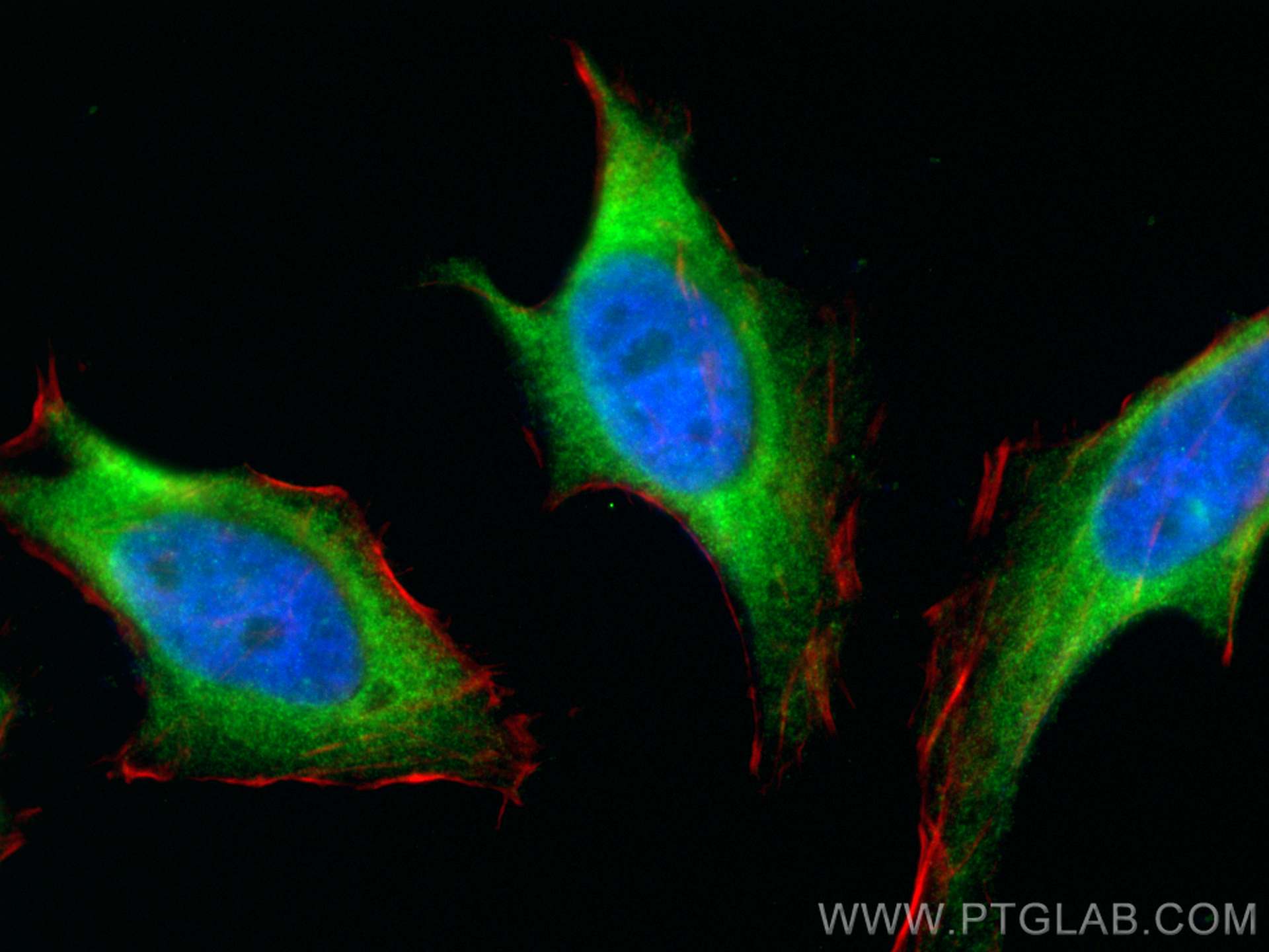 IF Staining of HeLa using 17619-1-AP