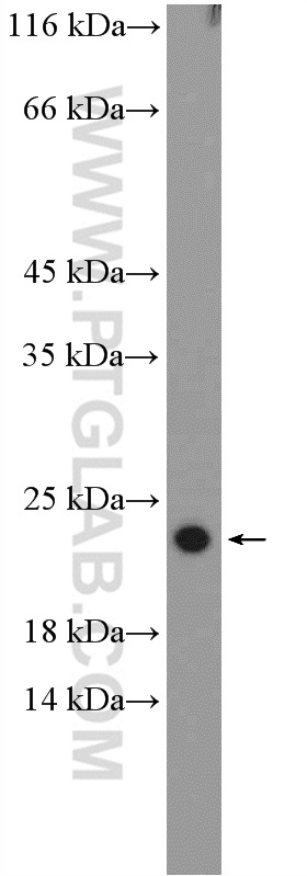 WB analysis of K-562 using 17619-1-AP