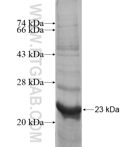 RPL26 fusion protein Ag11934 SDS-PAGE RPL26 fusion protein Ag11934 SDS-PAGE