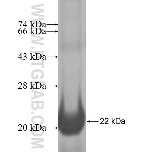 RPL27 fusion protein Ag6756 SDS-PAGE RPL27 fusion protein Ag6756 SDS-PAGE
