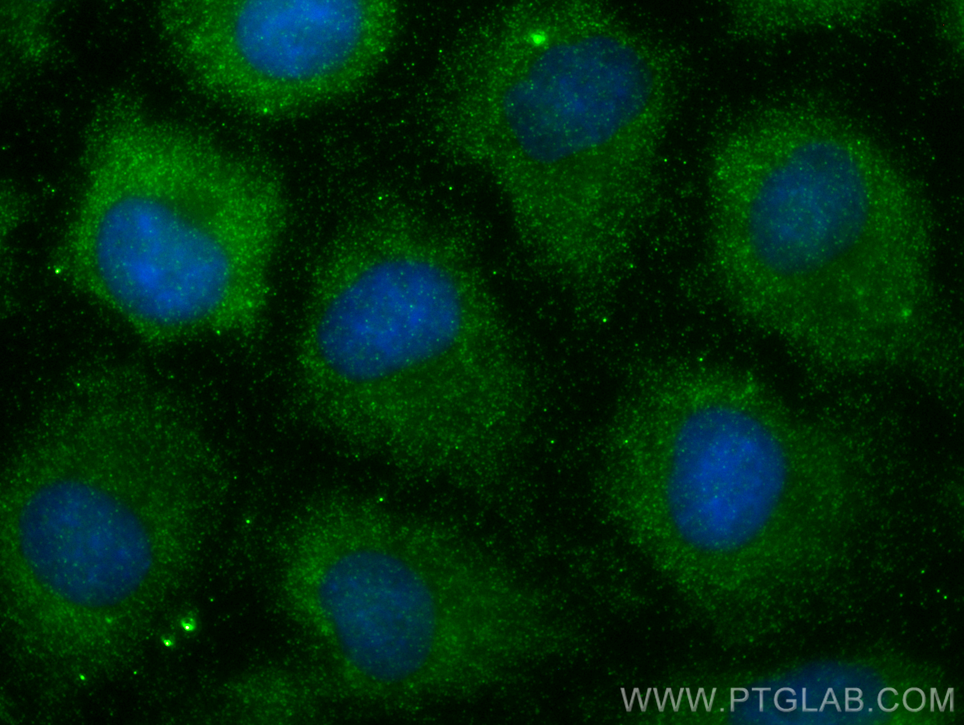 IF Staining of A549 using 16002-1-AP