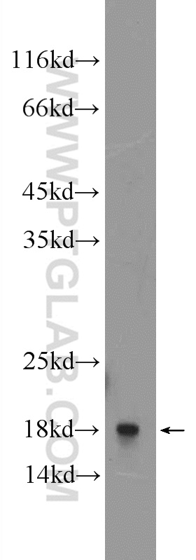 WB analysis of A549 using 16002-1-AP