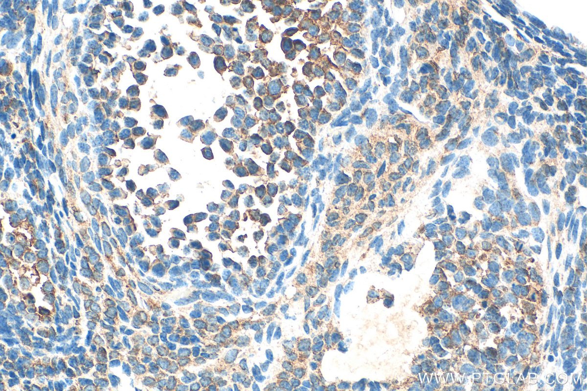 IHC staining of mouse ovary using 16649-1-AP